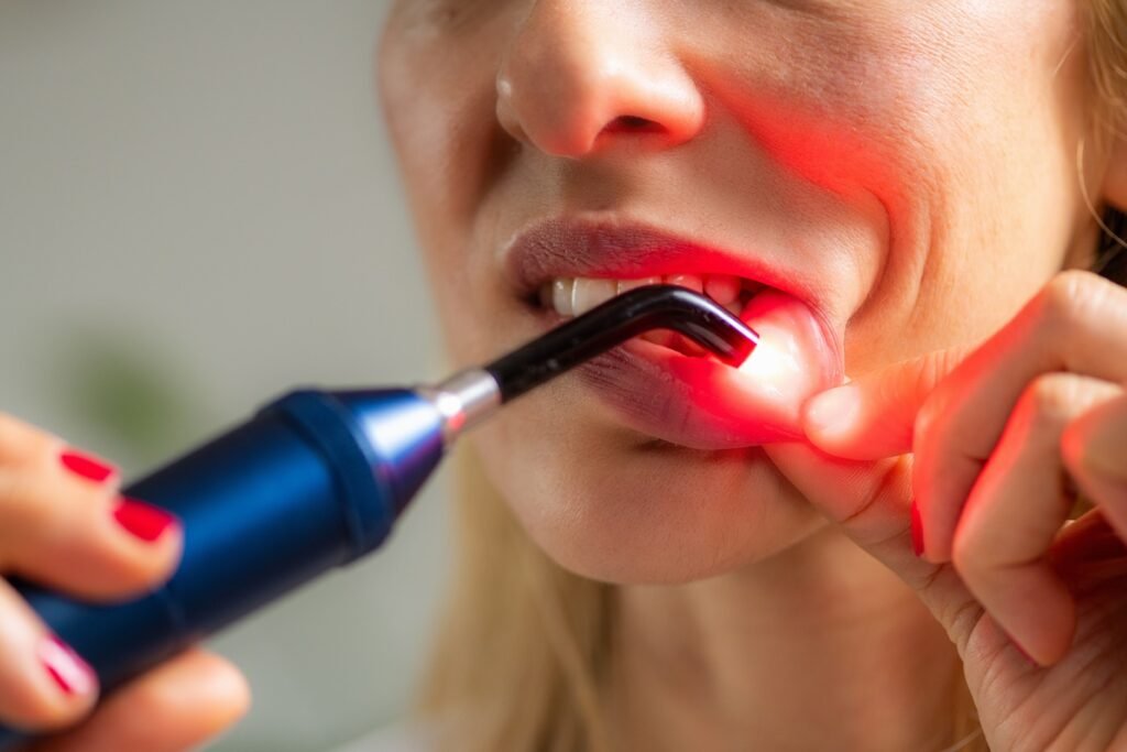 Laserterapia
